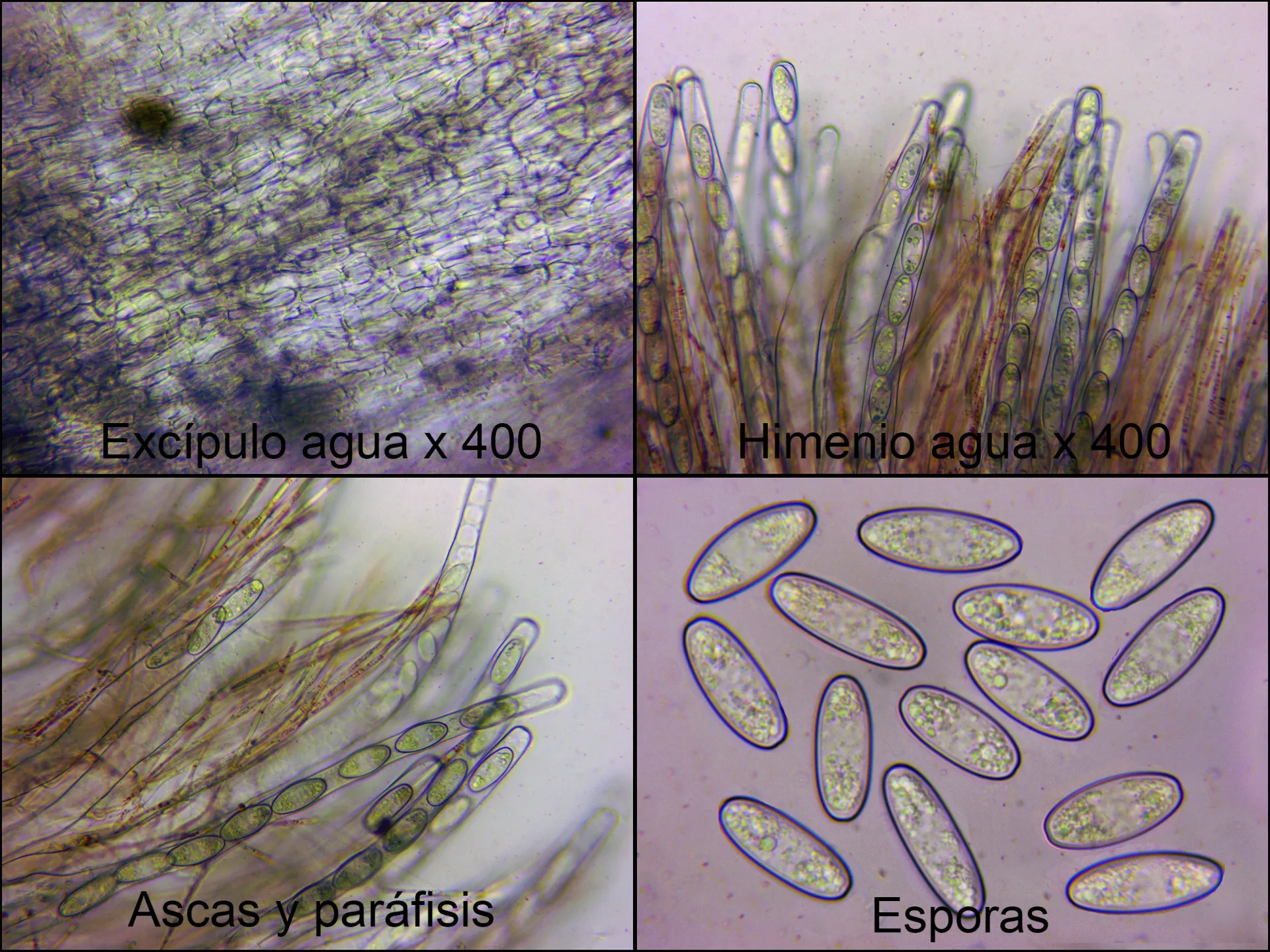 Microscopía de Sarcoscypha coccinea - 11 - micro